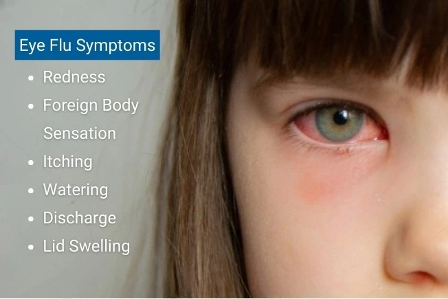 Most Common Symptoms of Viral Conjunctivitis
