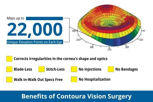 Benefits Of Contoura Vision Surgery