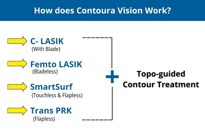 How Does Contoura Vision Surgery Works