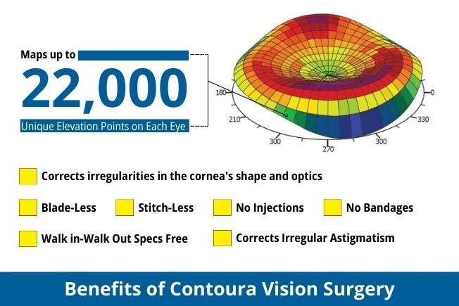 Benefits Of Contoura Vision Surgery