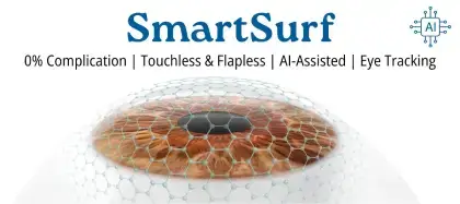 SmartSurf LASIK
