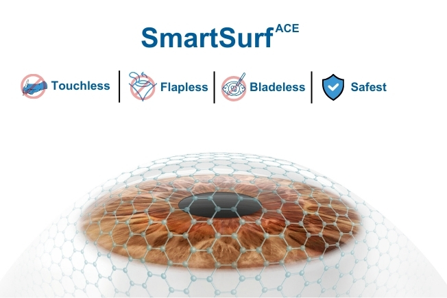 What is SmartSurf Surgery?