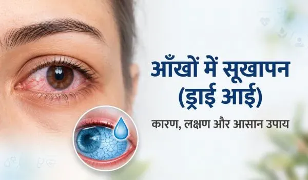 आंखों में सूखापन (ड्राई आई): कारण, लक्षण और इलाज