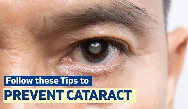 Cataract Prevention Tips