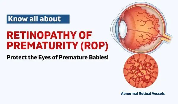 Retinopathy of Prematurity (ROP): Causes, Stages & Treatment