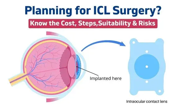Best ICL Surgery in Delhi | Cost, Eligibility & LASIK vs ICL