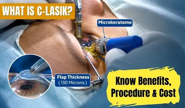 Customized LASIK Surgery: Cost, Benefits & Recovery
