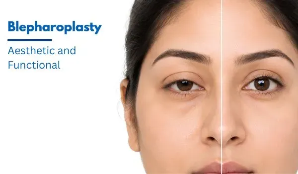 Blepharoplasty