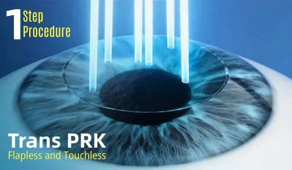 TransPRK LASIK